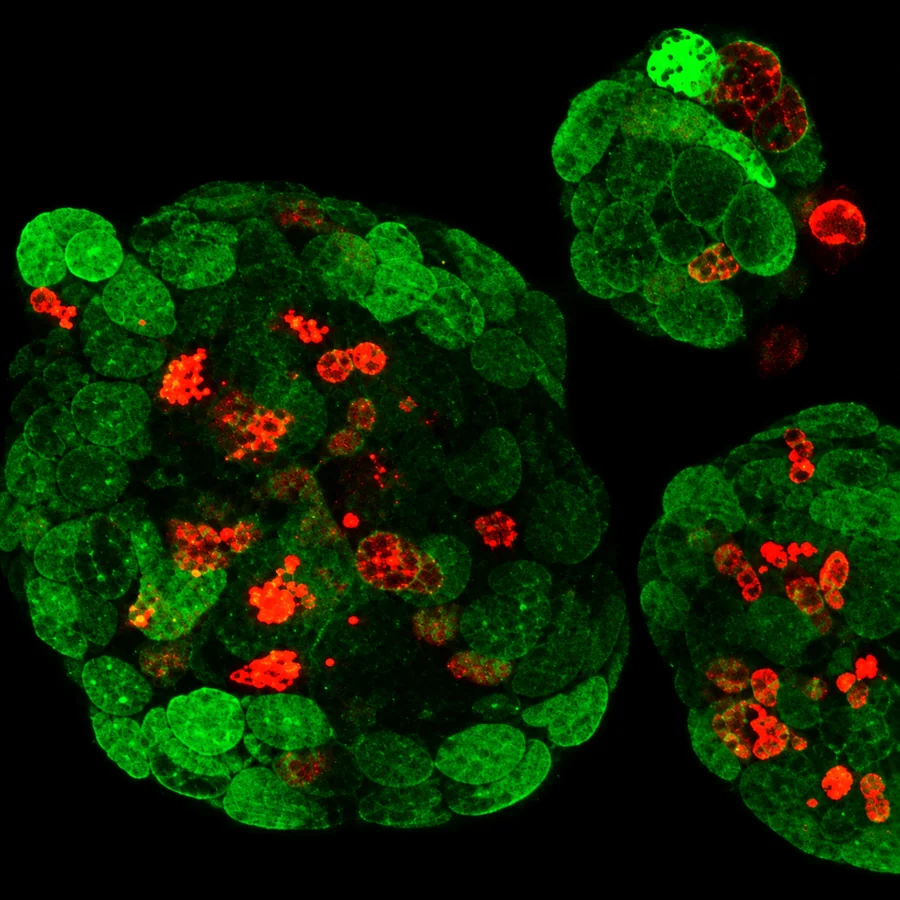 Color fluorescence microscopy of patient-derived organoids