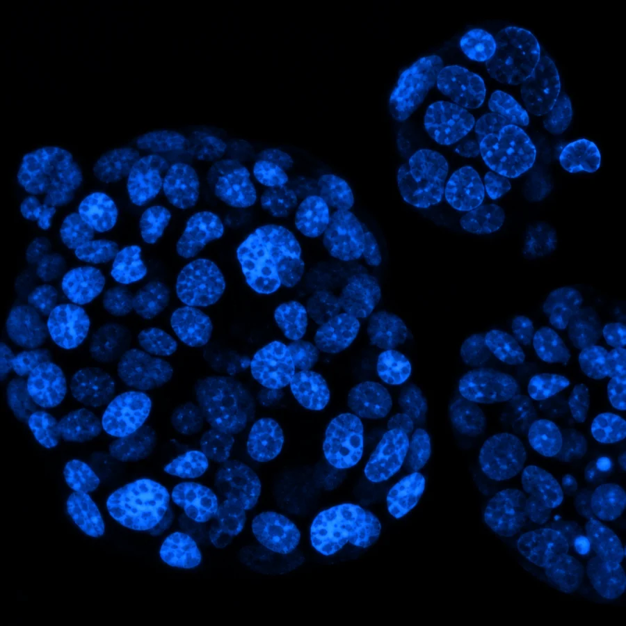 Blue fluorescence microscopy of patient-derived organoids